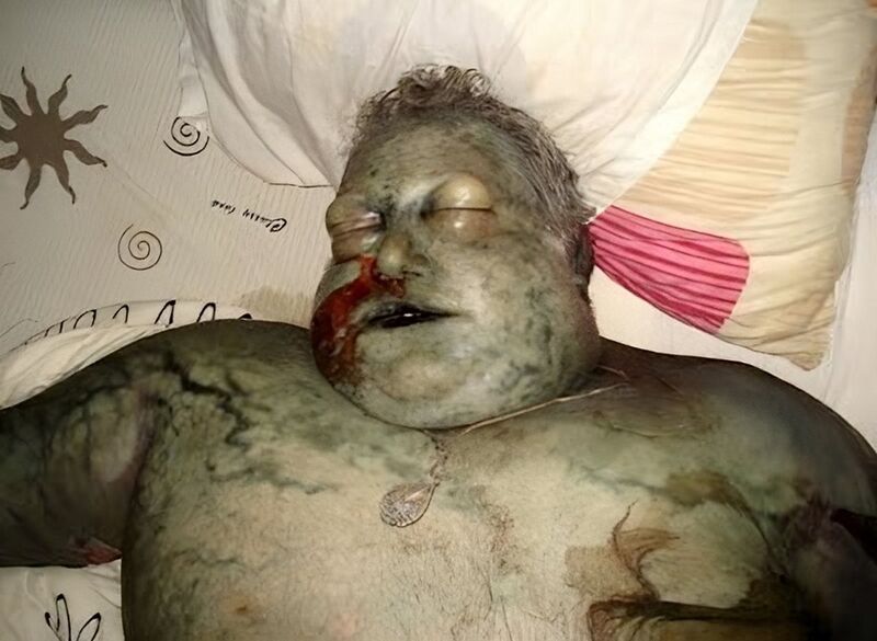 File:Bloated tranny corpse.jpg